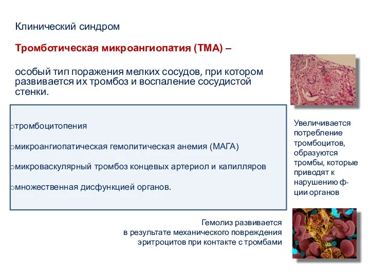 Клинический синдром Тромботическая микроангиопатия (ТМА) – особый тип поражения мелких сосудов, при котором