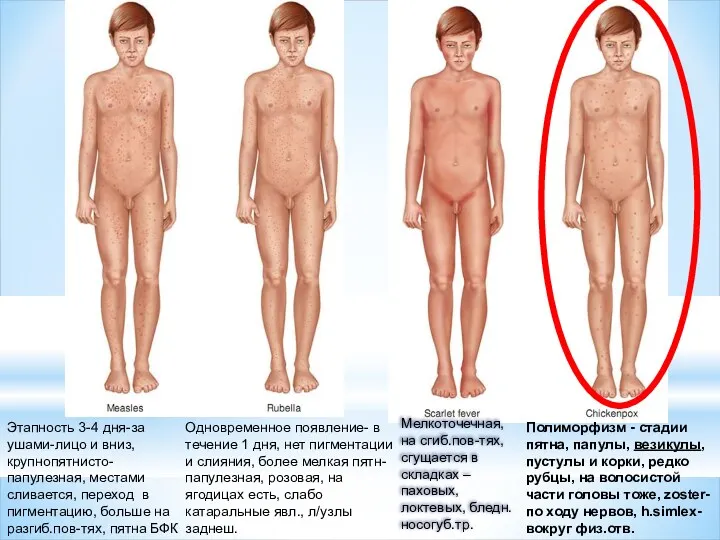 Полиморфизм - стадии пятна, папулы, везикулы, пустулы и корки, редко