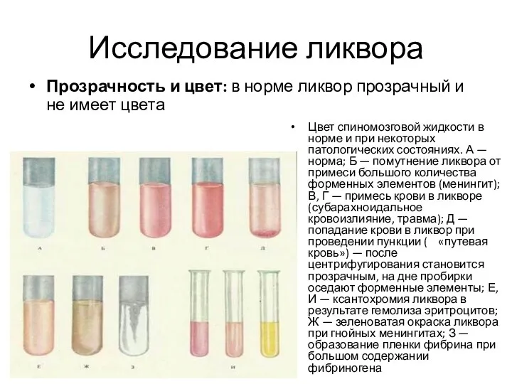 Исследование ликвора Прозрачность и цвет: в норме ликвор прозрачный и