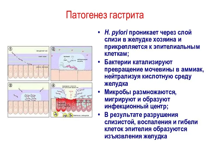 Патогенез гастрита H. pylori проникает через слой слизи в желудке