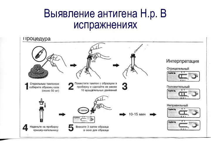 Выявление антигена Н.р. В испражнениях