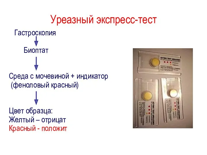 Уреазный экспресс-тест Гастроскопия Биоптат Среда с мочевиной + индикатор (феноловый