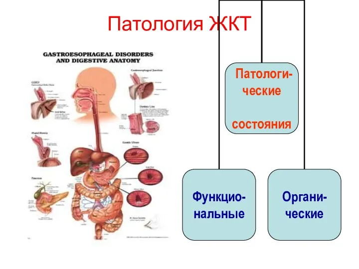 Патология ЖКТ