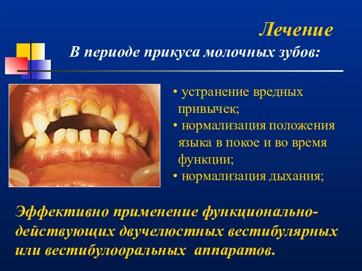 Лечение В периоде прикуса молочных зубов: устранение вредных привычек; нормализация
