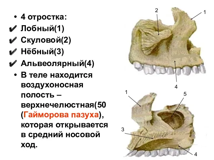 4 отростка: Лобный(1) Скуловой(2) Нёбный(3) Альвеолярный(4) В теле находится воздухоносная полость – верхнечелюстная(50