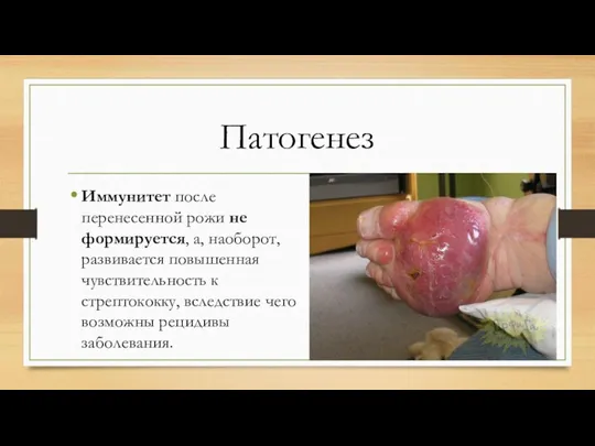 Патогенез Иммунитет после перенесенной рожи не формируется, а, наоборот, развивается