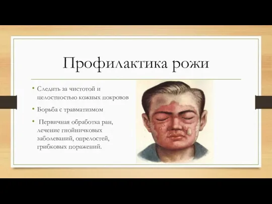 Профилактика рожи Следить за чистотой и целостностью кожных покровов Борьба