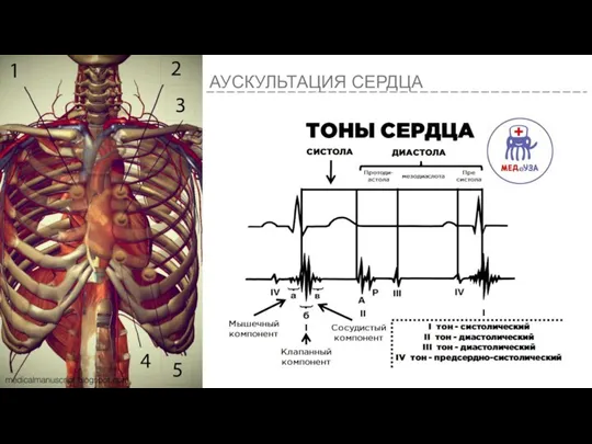 АУСКУЛЬТАЦИЯ СЕРДЦА