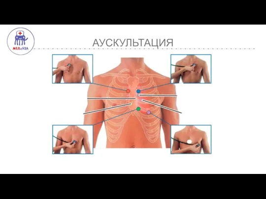 АУСКУЛЬТАЦИЯ