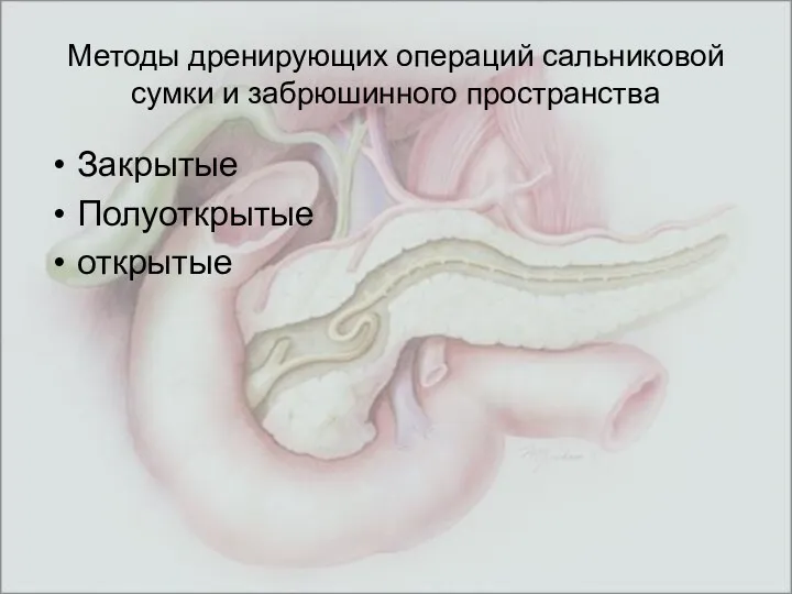 Методы дренирующих операций сальниковой сумки и забрюшинного пространства Закрытые Полуоткрытые открытые