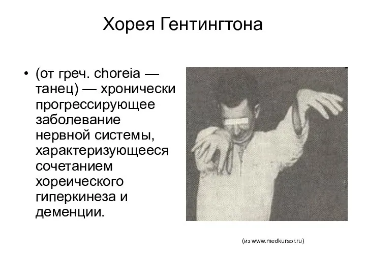 Хорея Гентингтона (от греч. choreia — танец) — хронически прогрессирующее