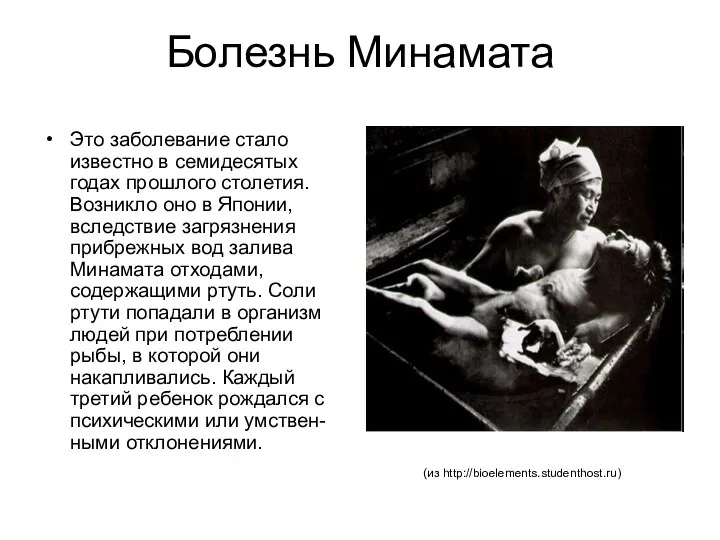 Болезнь Минамата Это заболевание стало известно в семидесятых годах прошлого