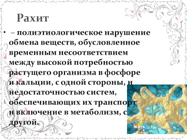 Рахит – полиэтиологическое нарушение обмена веществ, обусловленное временным несоответствием между