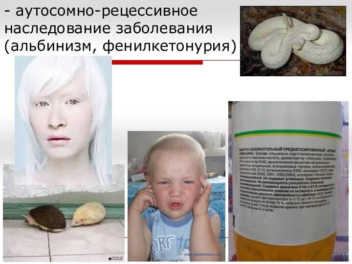 - аутосомно-рецессивное наследование заболевания (альбинизм, фенилкетонурия)