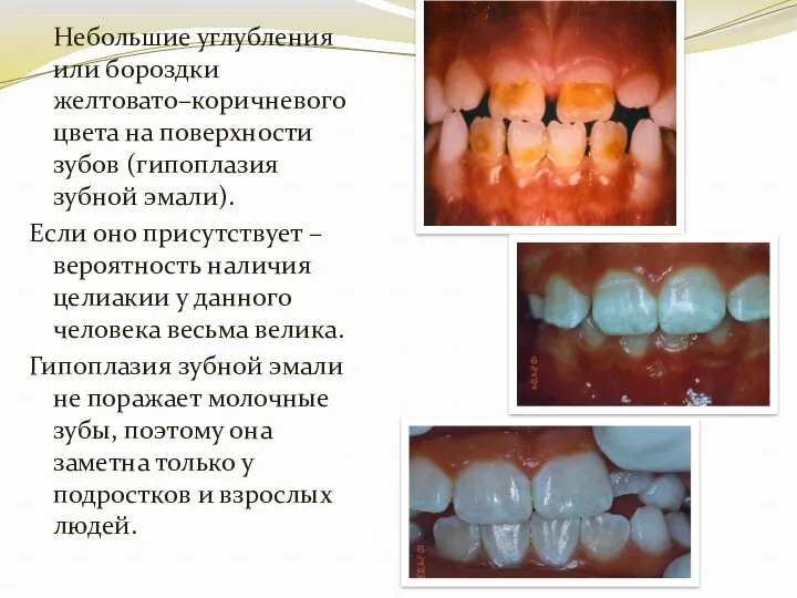 Aine et al. 90 Небольшие углубления или бороздки желтовато–коричневого цвета