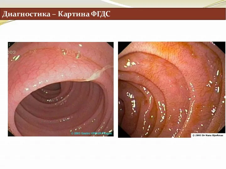 Диагностика – Картина ФГДС