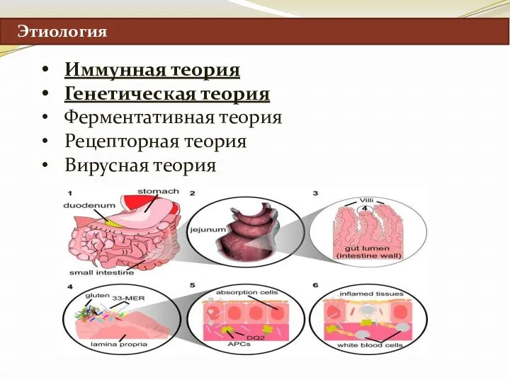 Этиология Иммунная теория Генетическая теория Ферментативная теория Рецепторная теория Вирусная теория