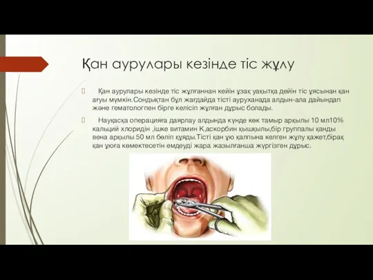 Қан аурулары кезінде тіс жұлу Қан аурулары кезінде тіс жұлғаннан