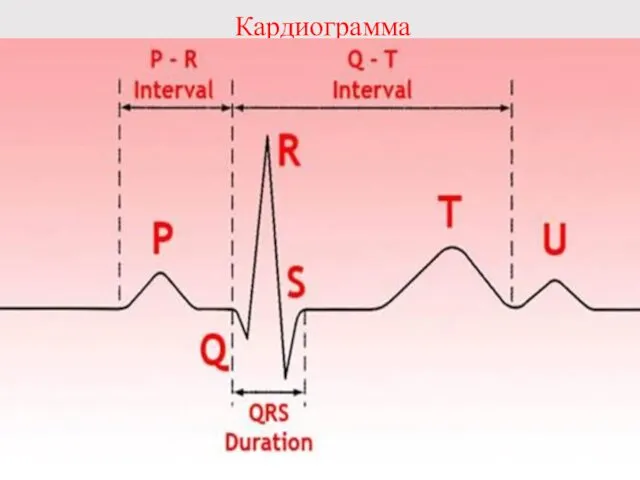 Кардиограмма