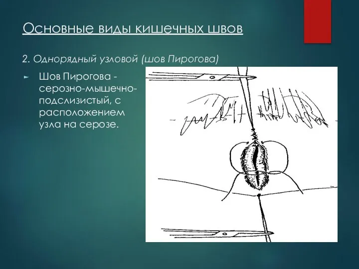 Основные виды кишечных швов 2. Однорядный узловой (шов Пирогова) Шов