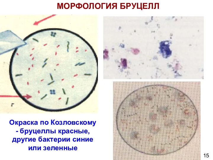 МОРФОЛОГИЯ БРУЦЕЛЛ Окраска по Козловскому - бруцеллы красные, другие бактерии синие или зеленные 15