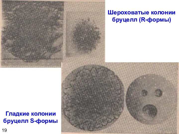 Шероховатые колонии бруцелл (R-формы) Гладкие колонии бруцелл S-формы 19