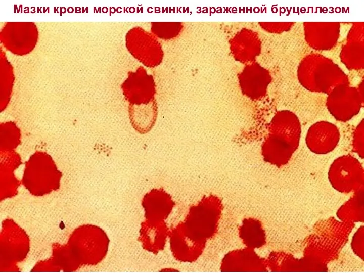 Мазки крови морской свинки, зараженной бруцеллезом 40