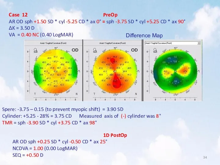 Case 12 PreOp AR OD sph +1.50 SD * cyl