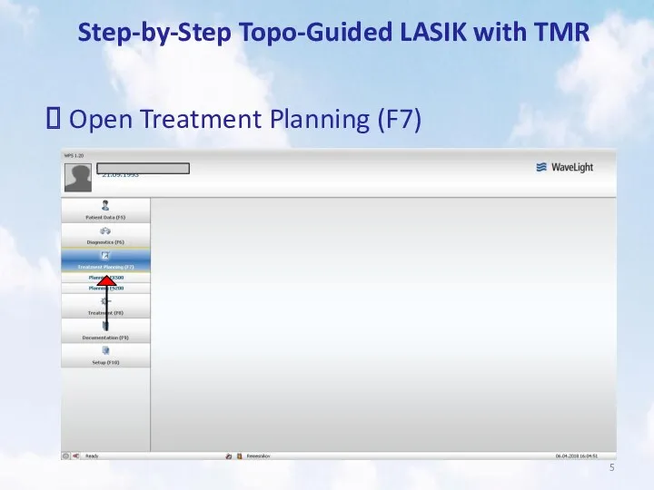 Step-by-Step Topo-Guided LASIK with TMR Open Treatment Planning (F7)