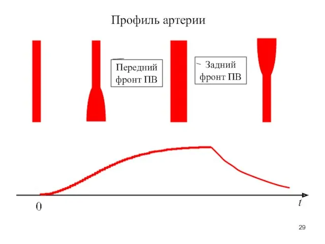 Профиль артерии Передний фронт ПВ Задний фронт ПВ