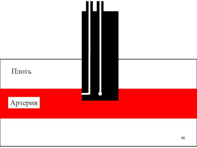 Плоть Артерия