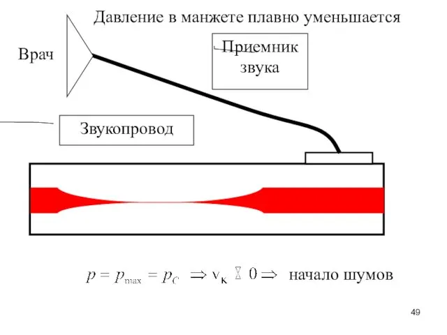 Приемник звука Звукопровод Врач начало шумов Давление в манжете плавно уменьшается