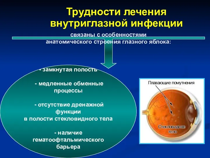 Трудности лечения внутриглазной инфекции связаны с особенностями анатомического строения глазного