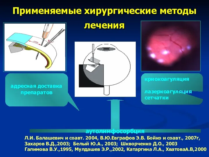 Применяемые хирургические методы лечения адресная доставка препаратов Л.И. Балашевич и