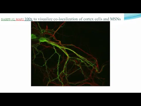 DARPP-32, MAP2 100х to visualize co-localization of cortex cells and MSNs