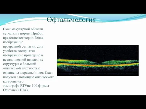 Офтальмология Скан макулярной области сетчатки в норме. Прибор представляет черно-белое