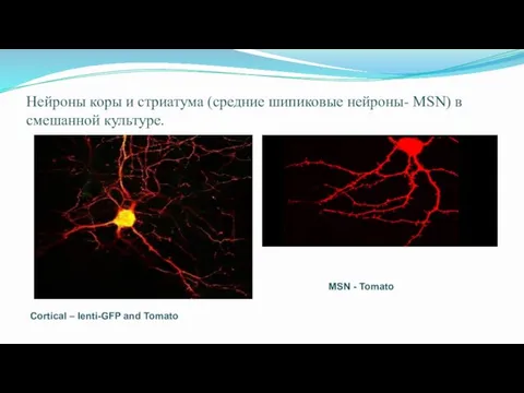 Нейроны коры и стриатума (средние шипиковые нейроны- MSN) в смешанной