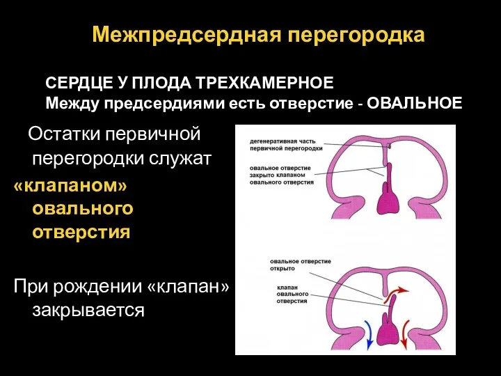 Остатки первичной перегородки служат «клапаном» овального отверстия При рождении «клапан»