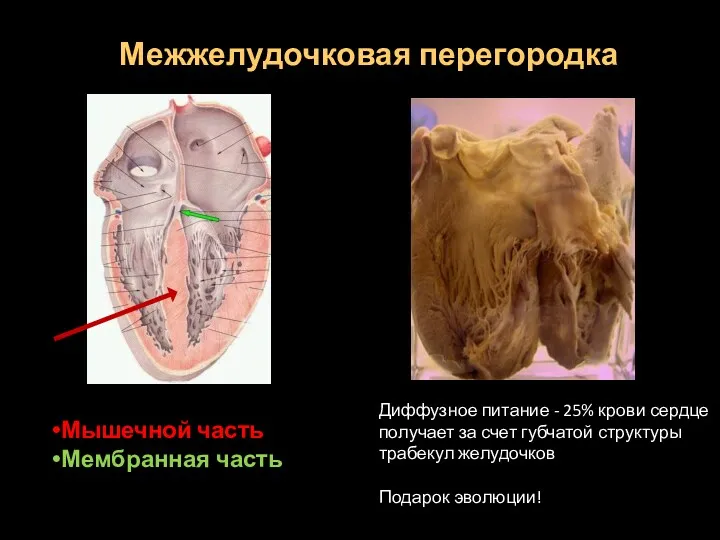 Межжелудочковая перегородка Мышечной часть Мембранная часть Диффузное питание - 25%