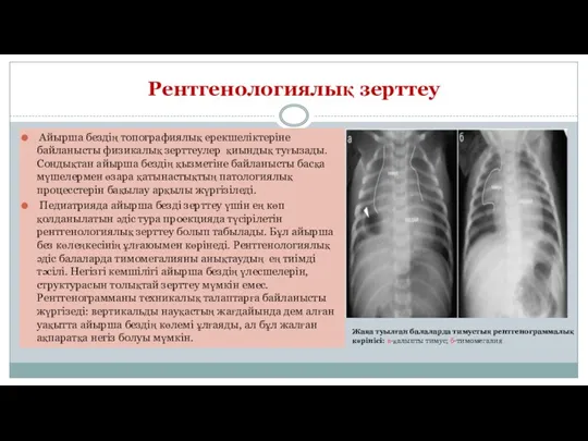 Рентгенологиялық зерттеу Айырша бездің топографиялық ерекшеліктеріне байланысты физикалық зерттеулер қиындық