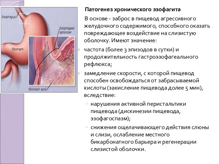 Патогенез хронического эзофагита В основе - заброс в пищевод агрессивного желудочного содержимого, способного