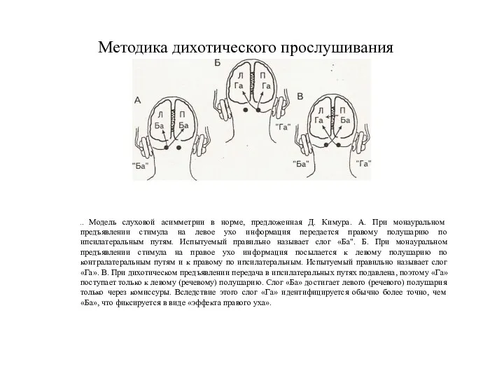 .. Модель слуховой асимметрии в норме, предложенная Д. Кимура. А. При монауральном предъявлении