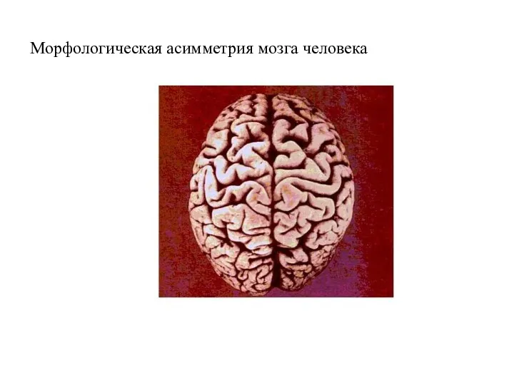 Морфологическая асимметрия мозга человека
