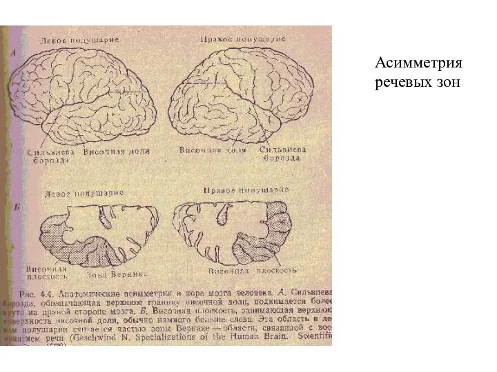 Асимметрия речевых зон