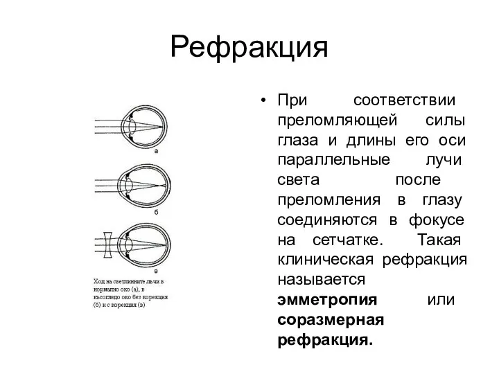 Рефракция При соответствии преломляющей силы глаза и длины его оси