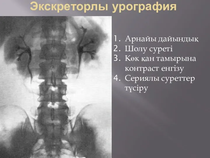 Экскреторлы урография Арнайы дайындық Шолу суреті Көк қан тамырына контраст енгізу Сериялы суреттер түсіру