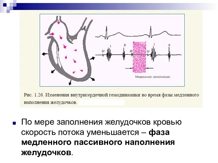 По мере заполнения желудочков кровью скорость потока уменьшается – фаза медленного пассивного наполнения желудочков.