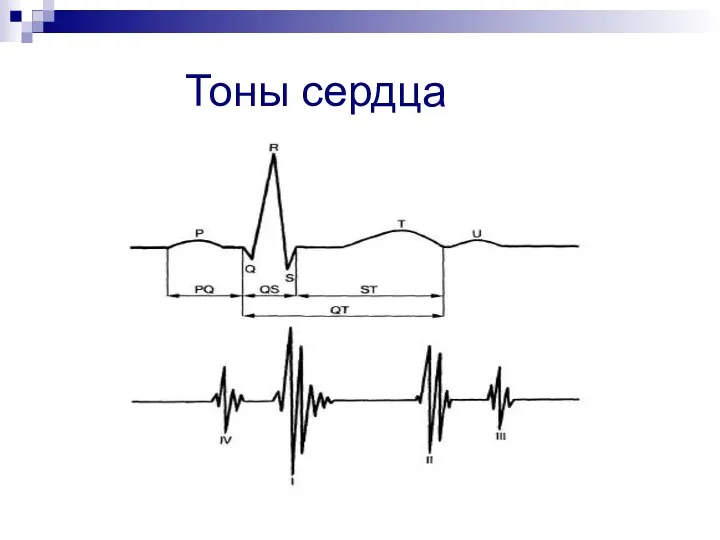 Тоны сердца