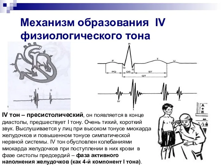 Механизм образования IV физиологического тона IV тон – пресистолический, он