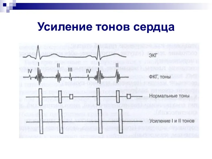 Усиление тонов сердца